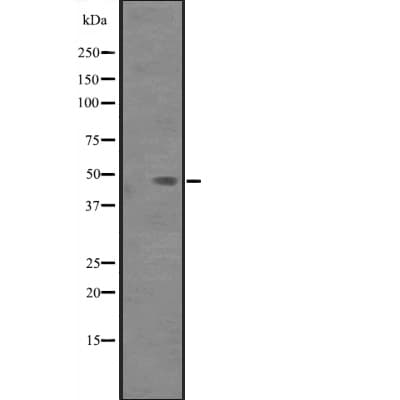 Polyclonal Rabbit anti-Human PAK1IP1 / HPIP1 Antibody (IHC, WB)