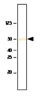IHC-plus™ SETD7 / SET7 Antibody (clone S4E5)