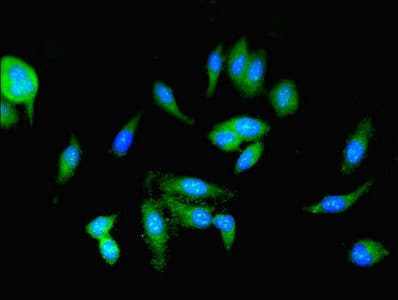 Polyclonal Rabbit anti-Human PKM / Pyruvate Kinase, Muscle Antibody (IHC)