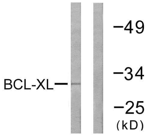 BCL2L1 / BCL-XL Antibody (p47)