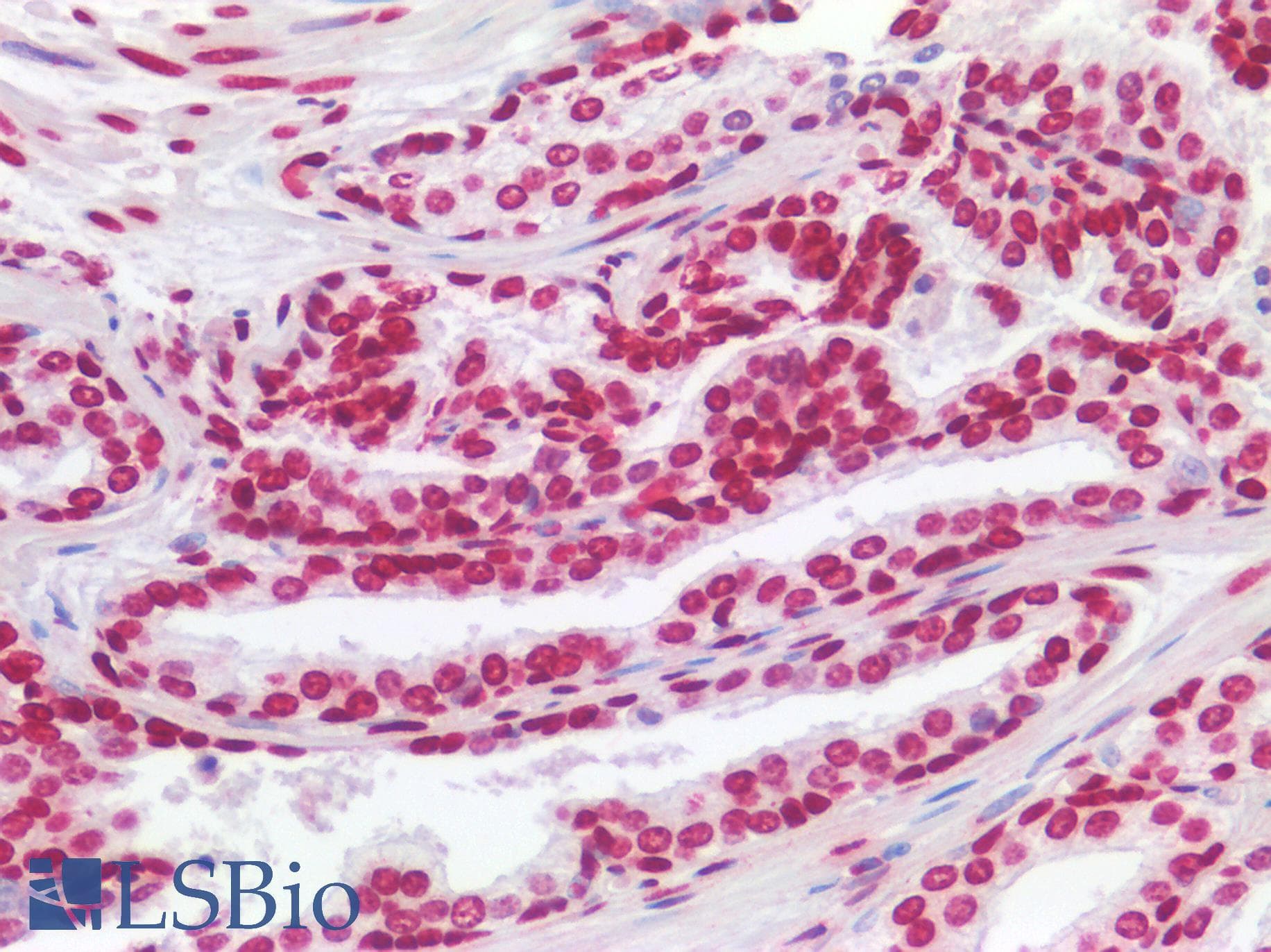IHC-plus™ Polyclonal Rabbit anti-Human HMG1 / HMGB1 Antibody (IHC)