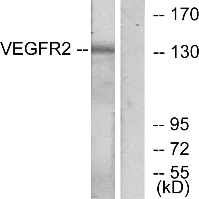 KDR / VEGFR2 / FLK1 Antibody (aa1141-1190)