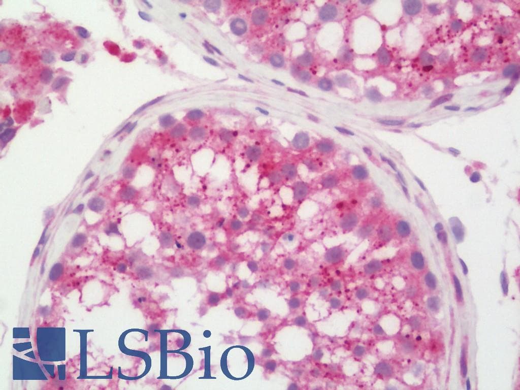 IHC-plus™ TNM / Teneurin-1 Antibody