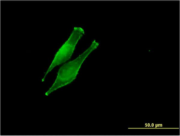 Monoclonal Mouse anti-Human DDOST / OST48 Antibody (clone 2D7, IF, WB)
