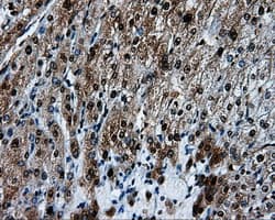 Heat Shock Protein 70 / HSPA1A Antibody (clone OTI3G9)