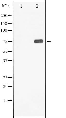 MAPT / Tau Antibody (phospho-Ser214)