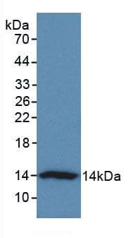 VTCN1 / B7-H4 Antibody (aa34-147, PE)