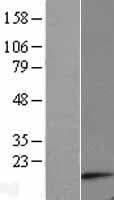 Human ATP5G1 / ATP5G Protein (Over-Expression Lysate Myc-DDK (Flag))