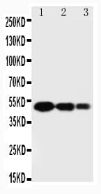 Polyclonal Rabbit anti-Human Osteonectin / SPARC Antibody (aa284-303, IHC, WB)