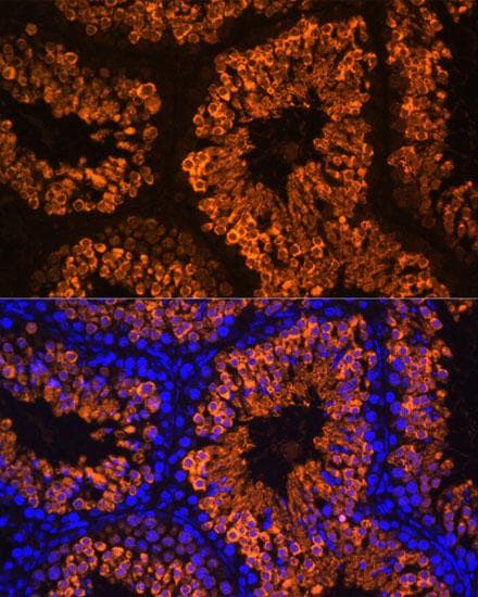 LDHC / Lactate Dehydrogenase C Antibody