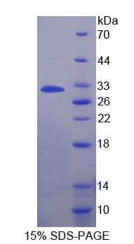 Human ADAM22 Protein (Recombinant His-T7)