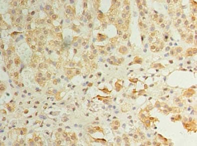 IHC-plus™ Polyclonal Rabbit anti-Human ZDHHC3 Antibody (IHC, WB)