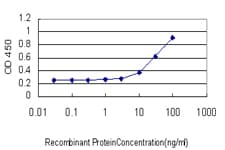 IHC-plus™ MBNL1 / MBNL Antibody (clone 3E7)