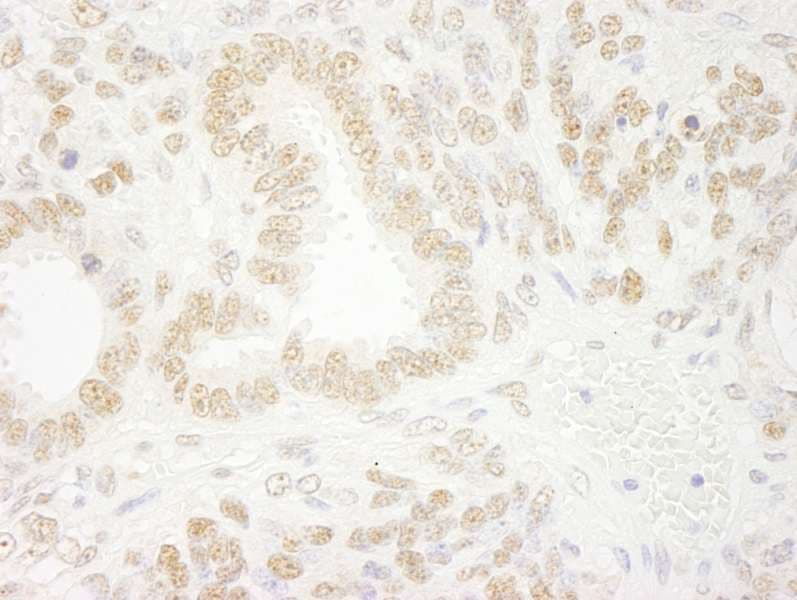 ZMYM2 / RAMP Antibody (aa1327-1377)
