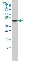RABGGTB Antibody (clone 1C2)