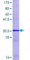 Human UGT2B15 Protein (Recombinant GST, N-terminus)