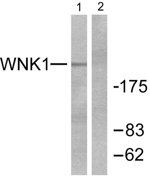 WNK1 Antibody (p58)
