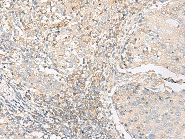 GLIS1 Antibody