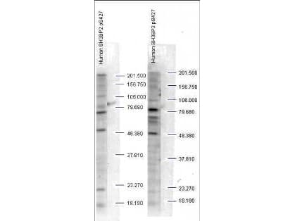 Polyclonal Rabbit anti-Human SH3BP2 Antibody (phospho-Ser427, WB)