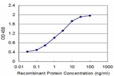 IHC-plus™ Neuropeptide Y / NPY Antibody (clone 3F8)