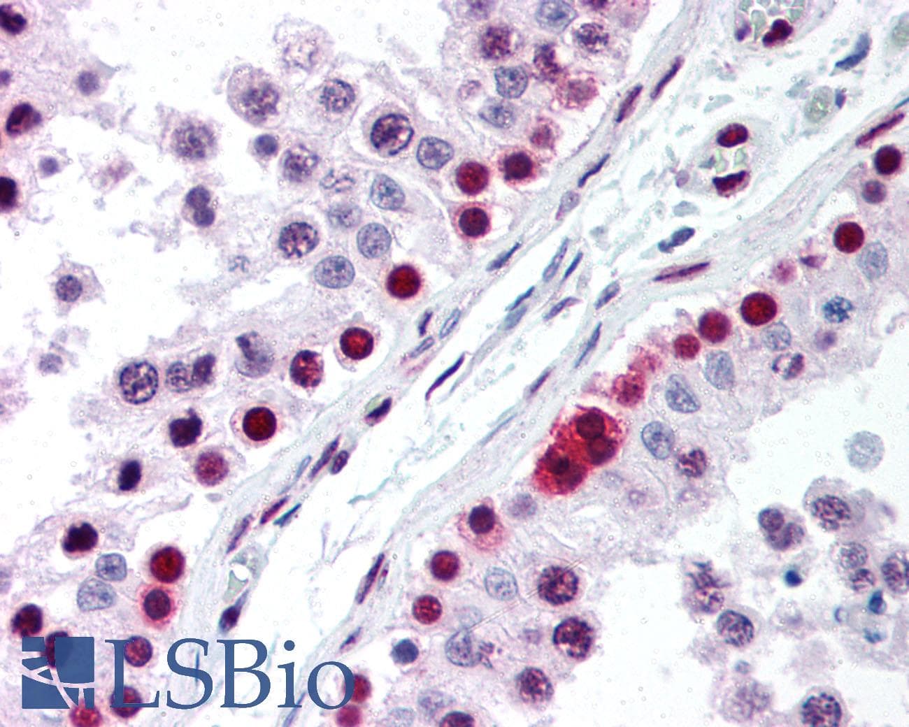 IHC-plus™ XRCC6 / Ku70 Antibody (N-Terminus, clone 529)