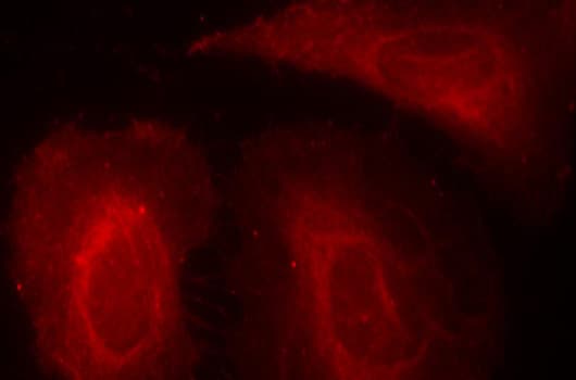 PDPK1 / PDK1 Antibody (phospho-Ser241)