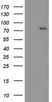 LIMK1 / LIMK Antibody (clone OTI6B4)
