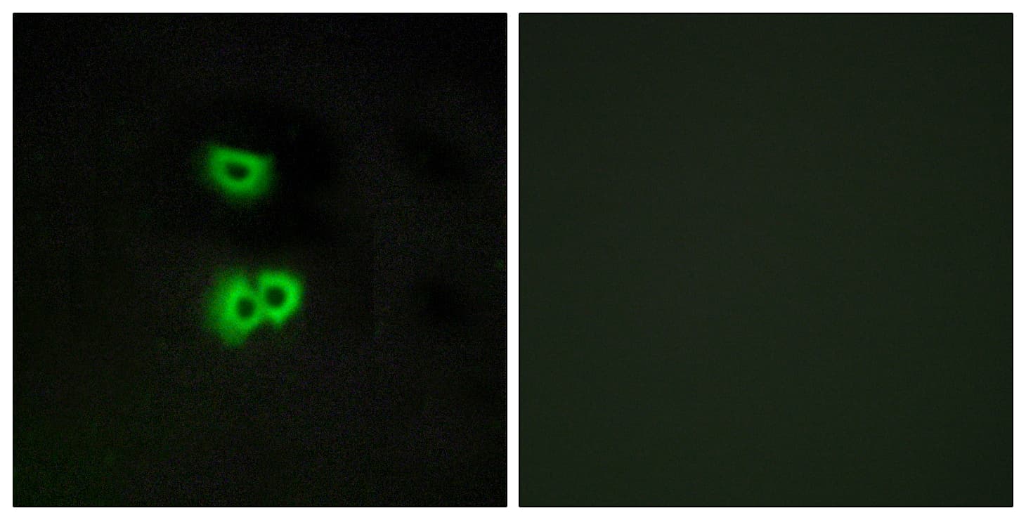 Polyclonal Rabbit anti-Human GPCR6 / GPR101 Antibody (aa245-294, IF)