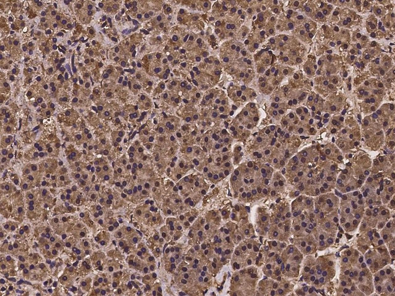 Polyclonal Rabbit anti-Human NUDT9 Antibody (IHC)