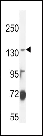 ABCC3 / MRP3 Antibody (aa899-925)