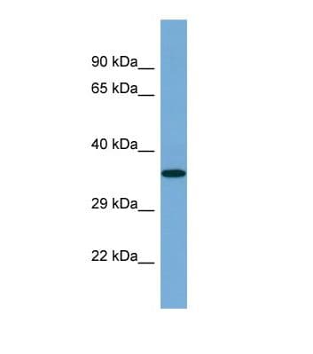 ARRDC4 Antibody (C-Terminus)