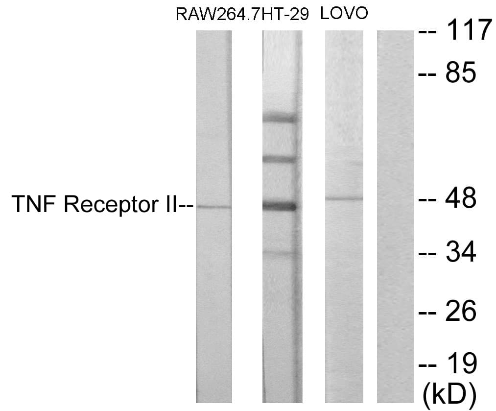 TNFRSF1B / TNFR2 Antibody (aa376-425)