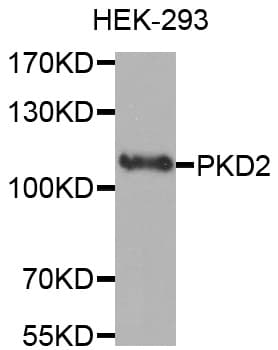 PKD2 / Polycystin 2 Antibody
