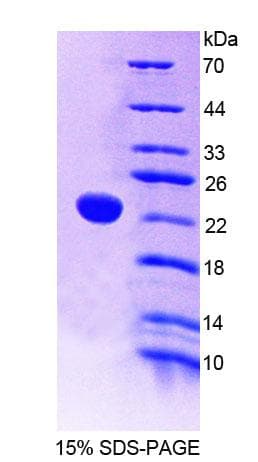 Human PTPRE / PTP Epsilon Protein (Recombinant His-T7, N-terminus)