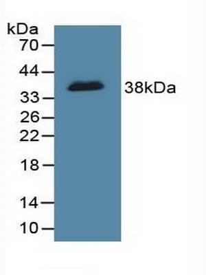 DFFA / ICAD / DFF45 Antibody (aa51-305, Biotin)