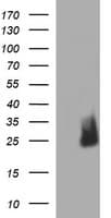 CHAC1 / MGC4504 Antibody (clone OTI1G1)
