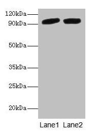 Polyclonal Rabbit anti-Human POSTN / Periostin Antibody (IHC, WB)