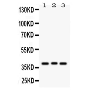WNT2 / IRP Antibody (aa56-81)