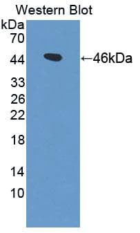 GSN / Gelsolin Antibody (aa434-782)