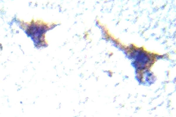 PRKD1 / PKC Mu Antibody (aa695-744)