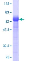 Human PARVA Protein (Recombinant GST)
