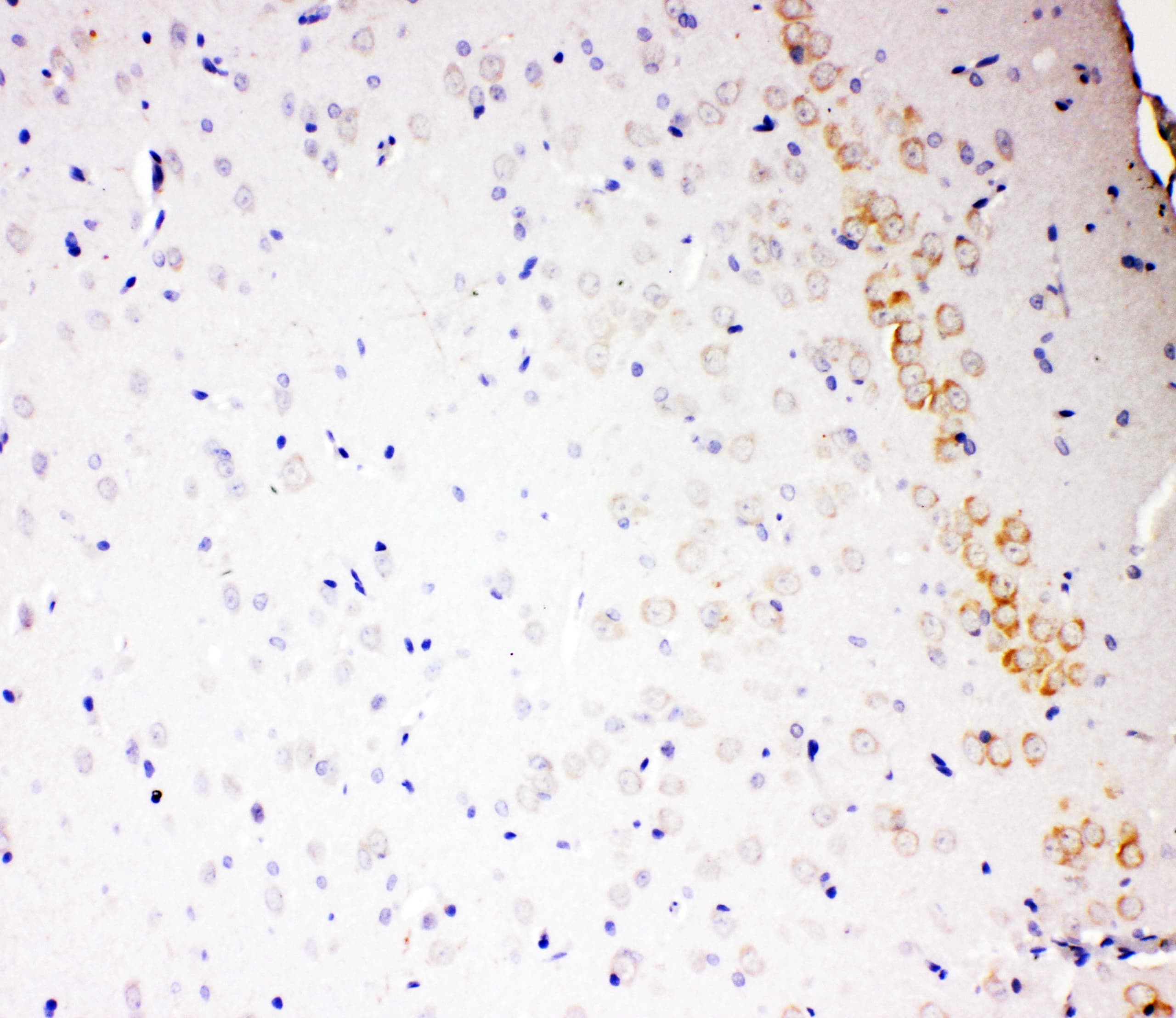 Polyclonal Rabbit anti-Human ALDH2 Antibody (aa18-33, IHC, WB)