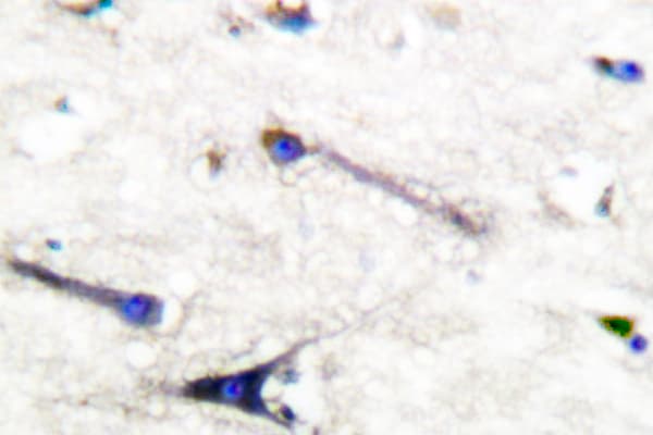 Polyclonal Rabbit anti-Human EZR / Ezrin Antibody (Ser539, IHC, WB)