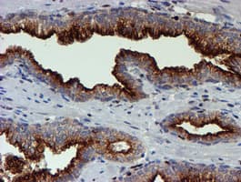 MEF2C Antibody (clone OTI4G8)