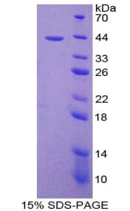 Bovine CCL8 / MCP2 Protein (Recombinant His-GST)