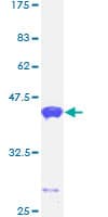 Human CALML5 Protein (Recombinant GST)