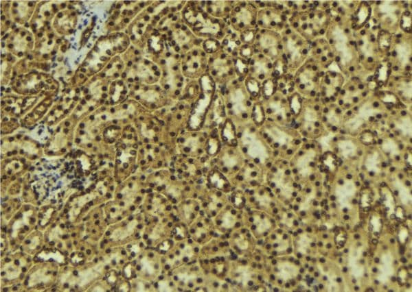DCLRE1C / Artemis Antibody