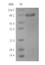 Influenza B Virus Nucleocapsid Protein (Recombinant 6His, N-terminus)