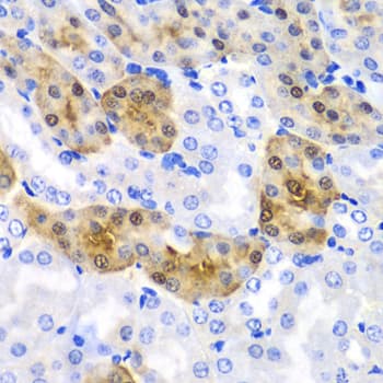 Polyclonal Rabbit anti-Human HPD Antibody (IHC, IF, WB)