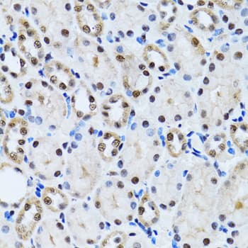 CCAR2 / KIAA1967 Antibody